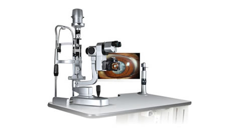 裂隙燈的工作原理